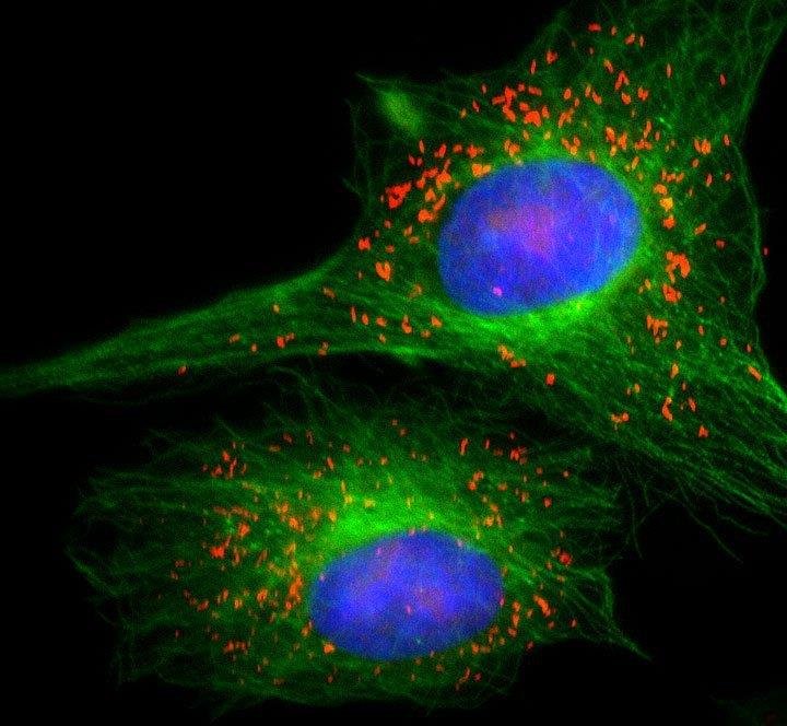 Fluorescence micrograph of cultured human cells: nuclear DNA stained blue with DAPI, tubulin filaments green, peroxisomes red