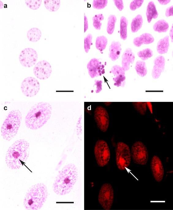 Feulgen stained cell nuclei, pink DNA staining in panels a to c and a red fluorescent DNA stain in panel d, arrows marking a dense chromatin focus