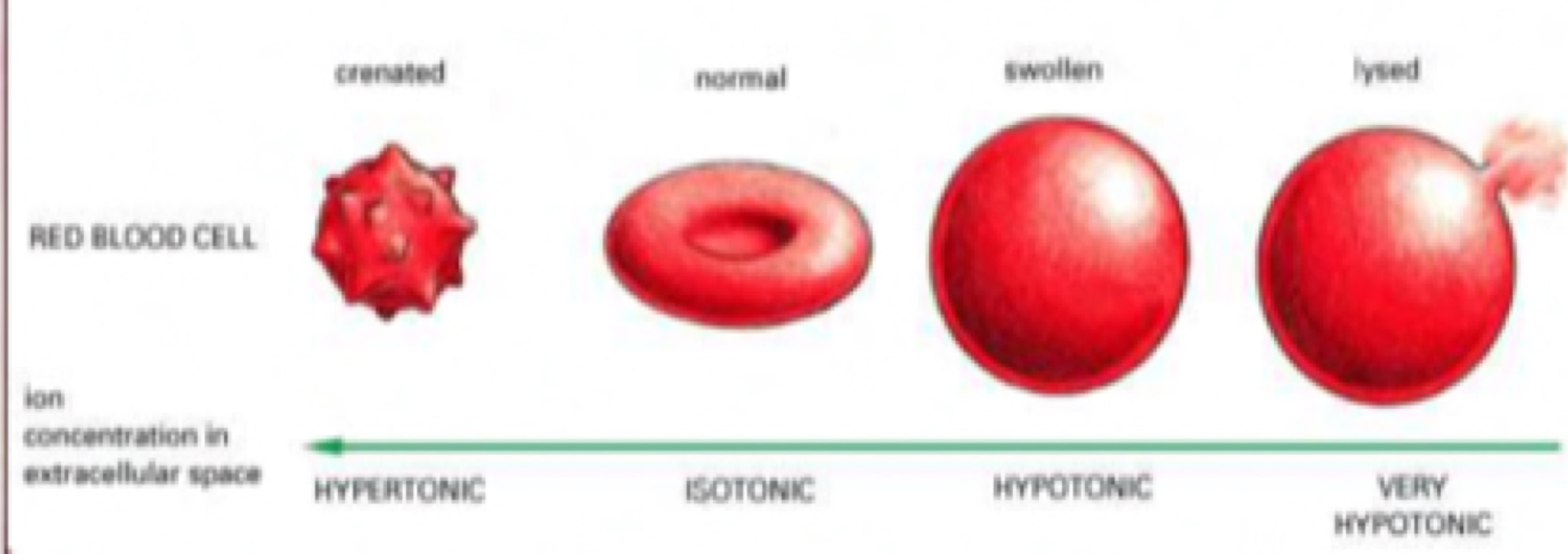 Four red blood cells shown crenated, normal, swollen and lysed as the ion concentration of the surrounding fluid falls from hypertonic through isotonic to very hypotonic