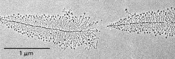 Electron micrograph of rRNA genes in a Christmas tree pattern, each tree one transcription unit with progressively longer growing RNA transcripts along its length