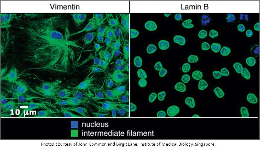 Immunofluorescence comparing cytoplasmic vimentin intermediate filaments with nuclear lamin B, nuclei counterstained blue