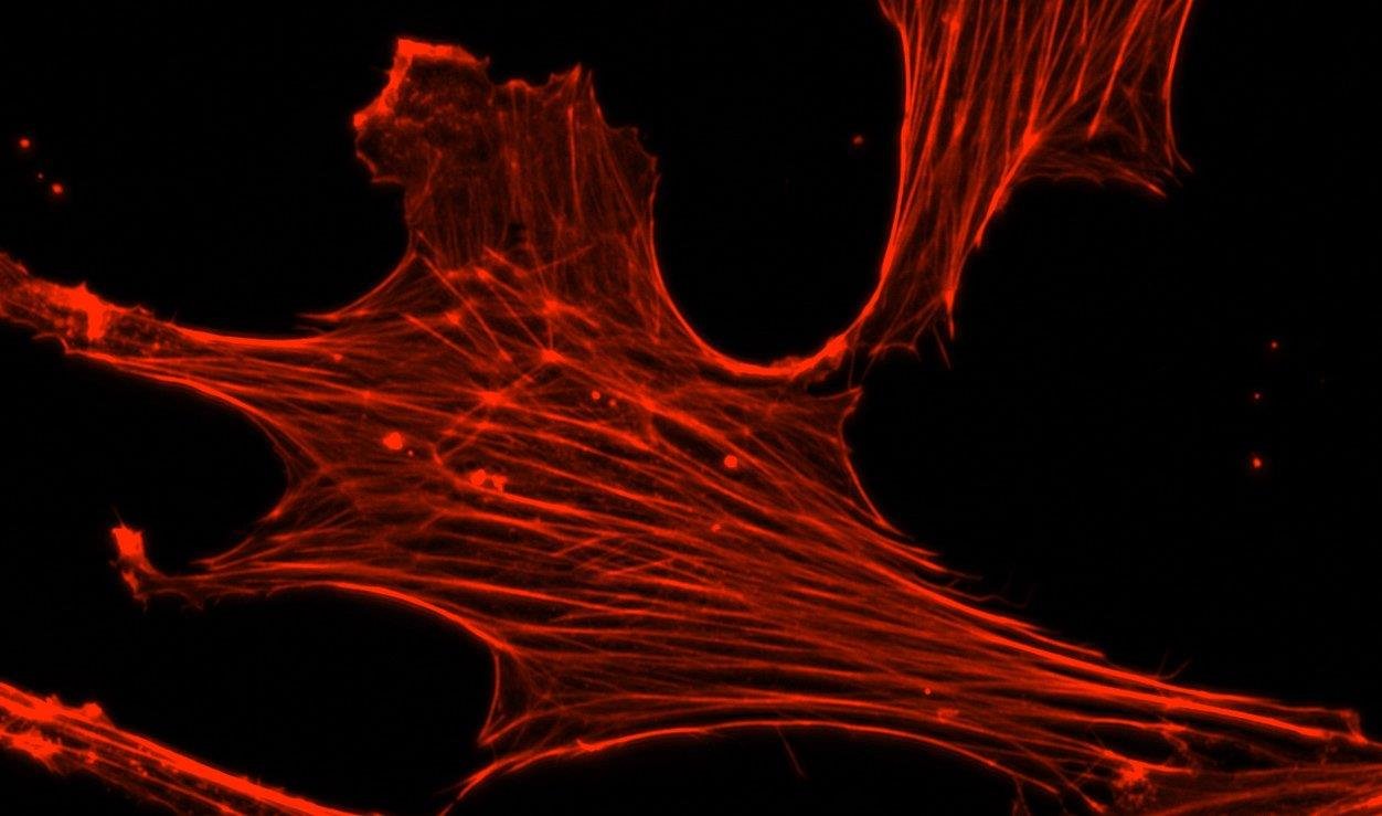 Actin stress fibres in a cell stained with phalloidin-rhodamine, fluorescing under UV light
