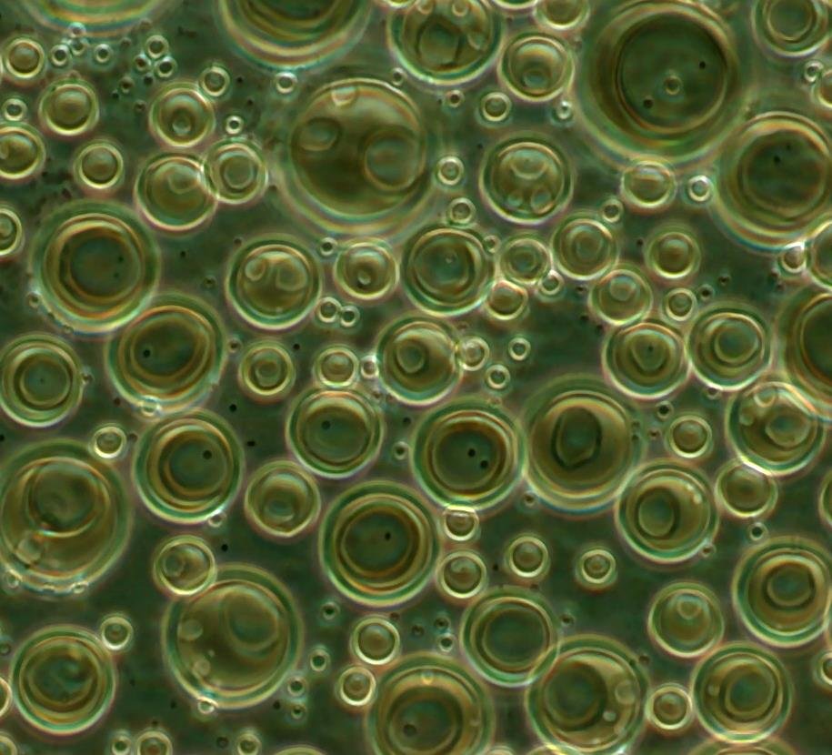 Phase-contrast micrograph of laboratory-made liposomes as round vesicles of varying size, unlabelled