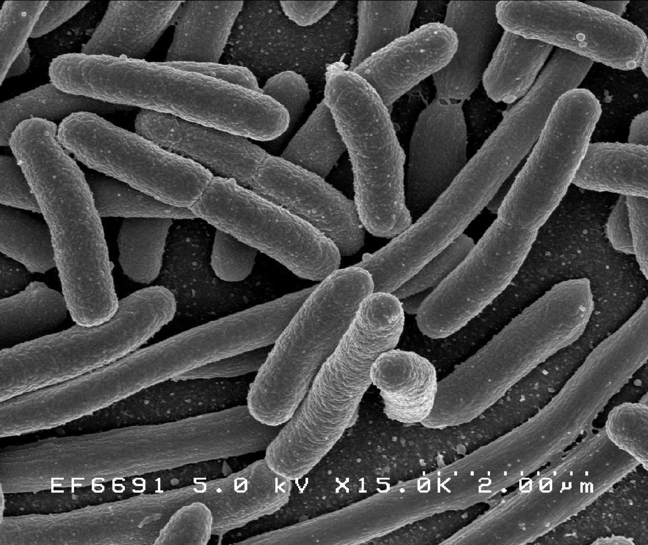 Scanning electron micrograph of rod-shaped Escherichia coli bacteria clustered together, unlabelled