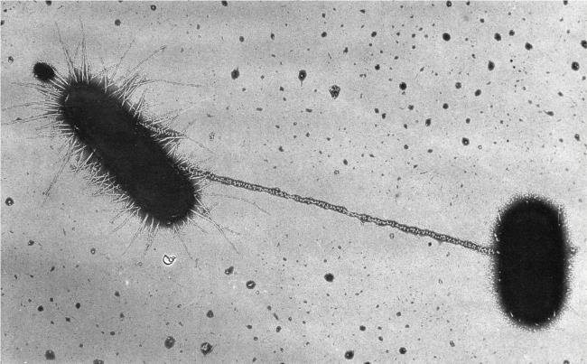 Electron micrograph of two Escherichia coli cells joined by a conjugation pilus during bacterial conjugation, unlabelled